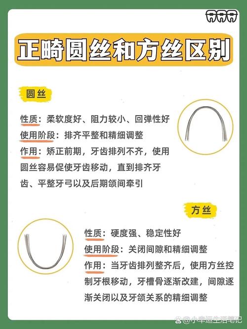 正畸澳丝属于什么-图3 正畸澳丝属于什么-图3