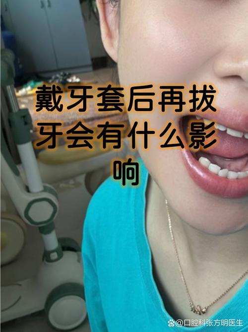 拔牙后会影响正畸效果吗?-图2 拔牙后会影响正畸效果吗?-图2
