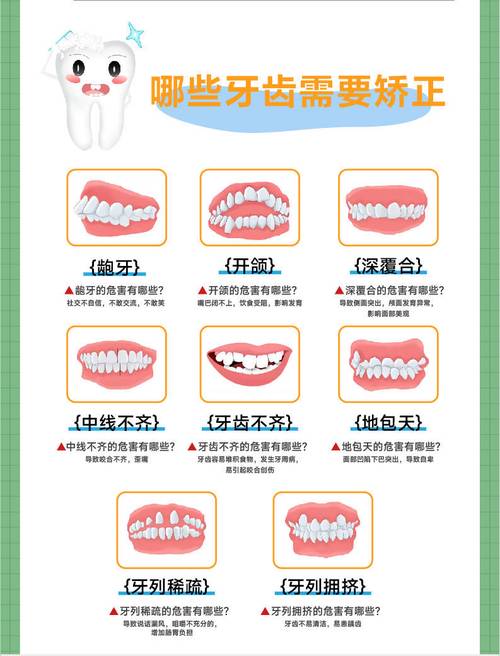 口腔正畸病种名称-图2