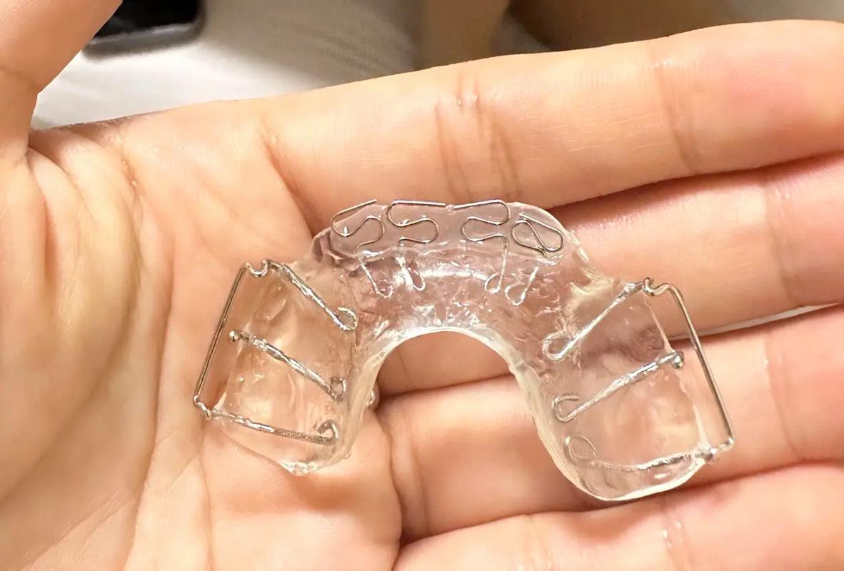 正畸个性化定制,如何根据个体差异定制?效果真的更好吗?-图3 正畸个性化定制,如何根据个体差异定制?效果真的更好吗?-图3