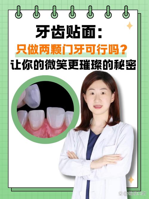 牙贴面能做正畸吗-图2 牙贴面能做正畸吗-图2