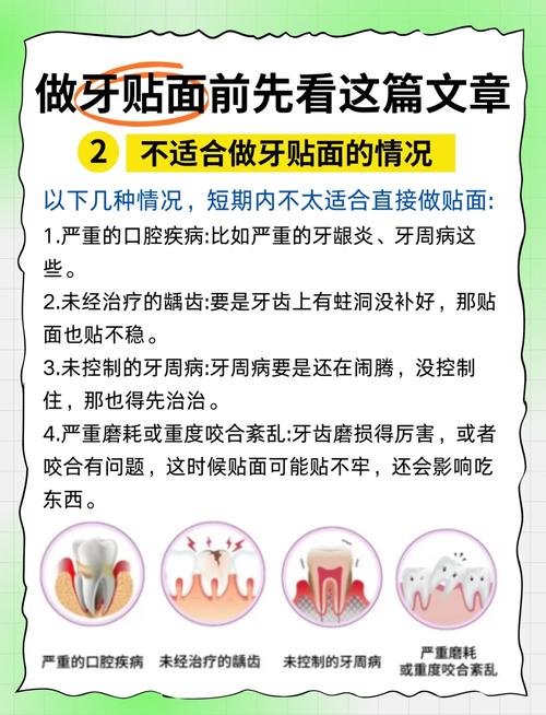 牙贴面能做正畸吗-图1 牙贴面能做正畸吗-图1