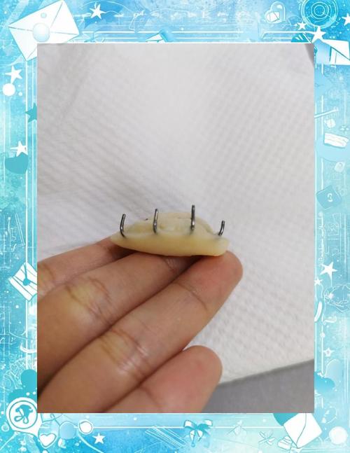 正畸平面导板厚度-图1 正畸平面导板厚度-图1