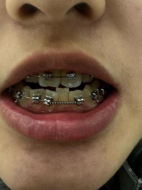 长春吉林大学正畸-图2