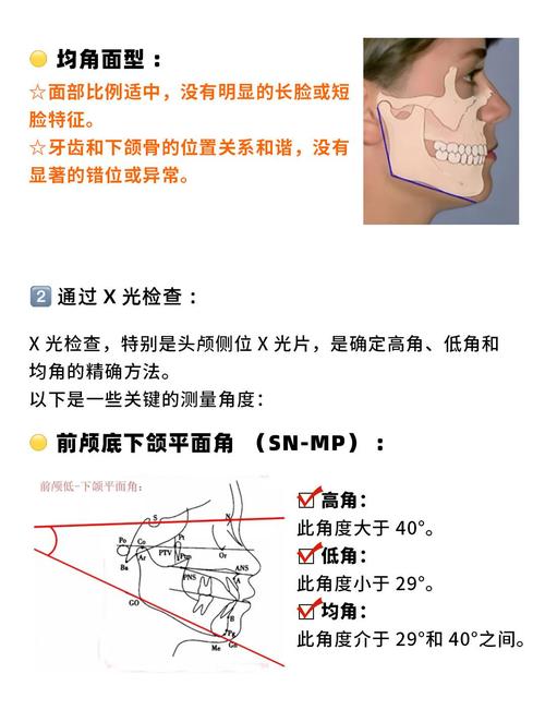 正畸面型角的定义究竟指什么？-图2