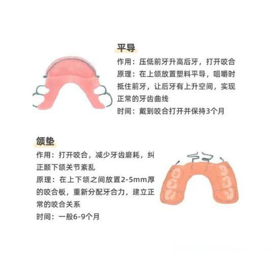 正畸平面导板制作的流程、材料及注意事项有哪些？-图1