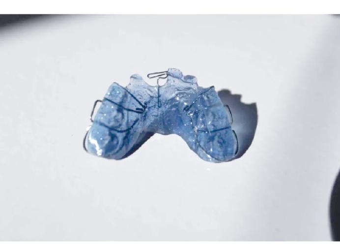 正畸治疗中常用器械有哪些类型及作用？-图2