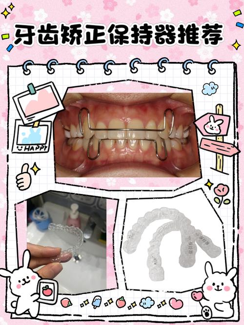 正畸需要什么装备-图1 正畸需要什么装备-图1