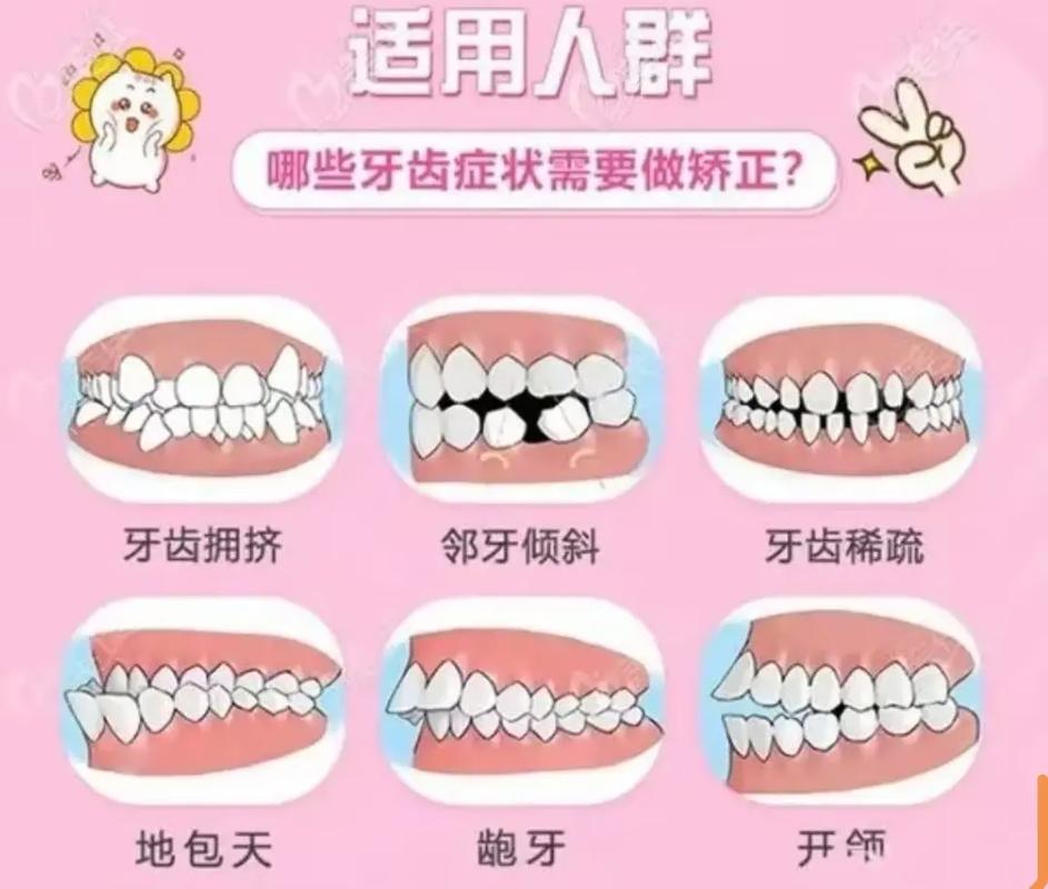 口腔正畸先学什么-图2