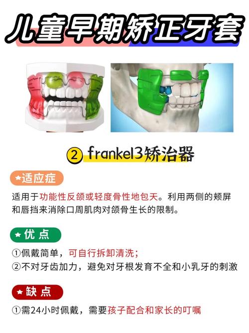 多大孩子可以正畸-图2