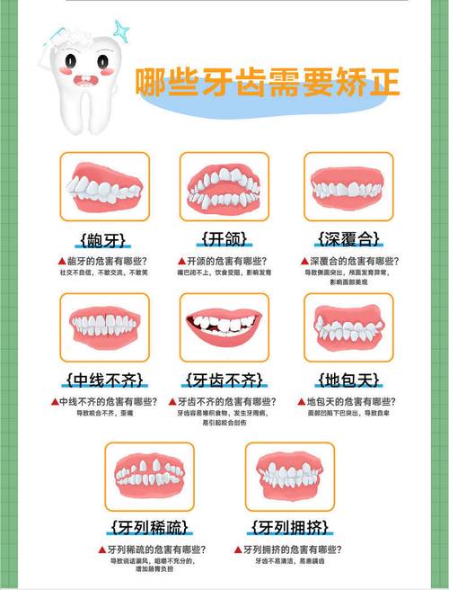 正畸设计分哪几类？-图2