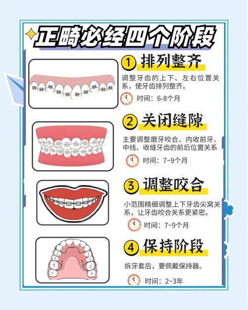 咬合板正畸治疗整个过程的时间安排一般是怎样的？-图2