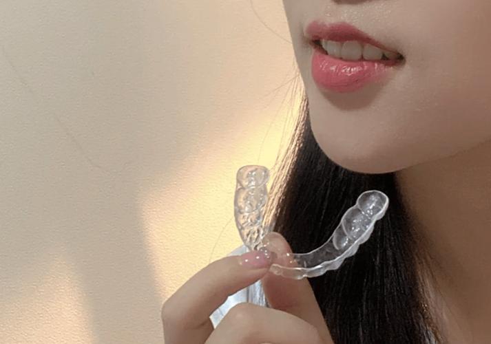 透明牙套正畸试戴-图2