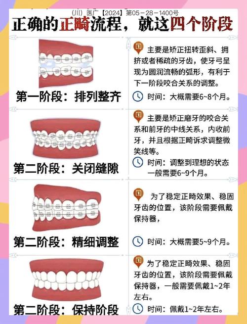 反颌正畸治疗计划-图3