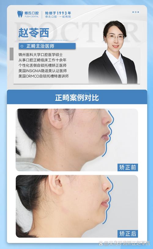前牙覆合覆盖异常，正畸矫正需关注哪些关键问题？-图1