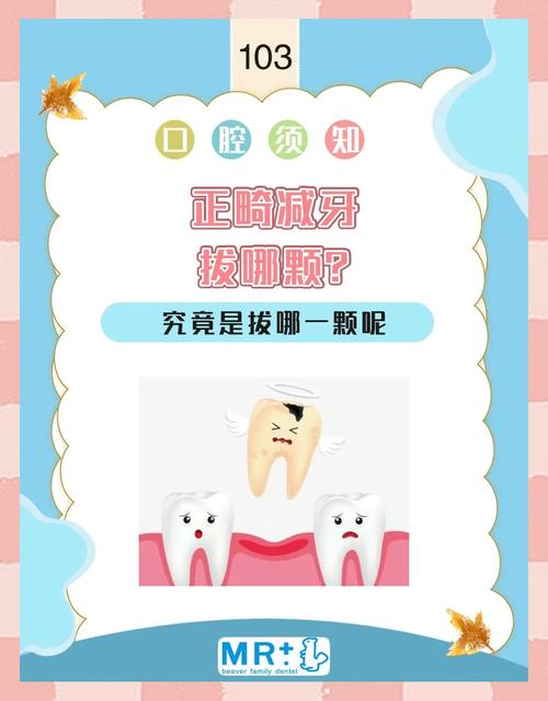 正畸拔牙的准则有哪些?如何判断是否需要拔牙?-图3 正畸拔牙的准则有哪些?如何判断是否需要拔牙?-图3