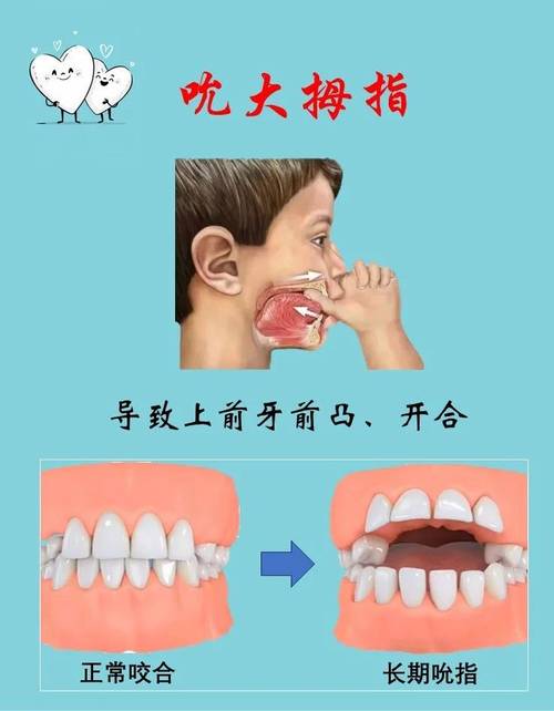 儿童口腔正畸去哪儿做？专业靠谱的医院怎么选？-图1