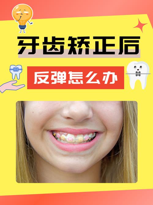 微正畸矫后会反弹-图1