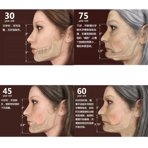 正畸治疗如何通过面部美学分析优化面部美观效果？-图1