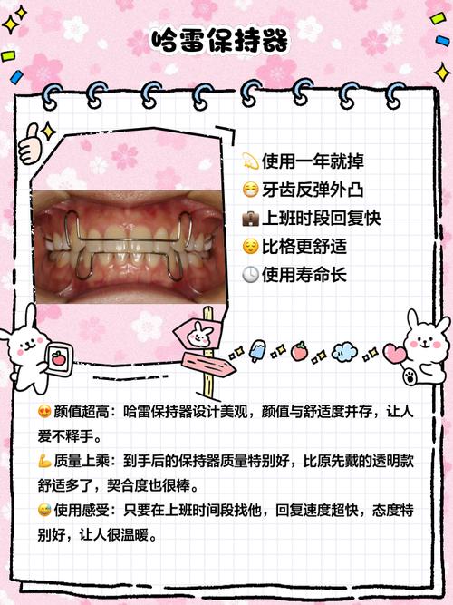 正畸保持器 磨牙-图1