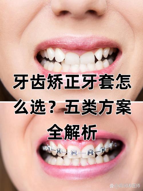 去哪里牙齿正畸好-图3