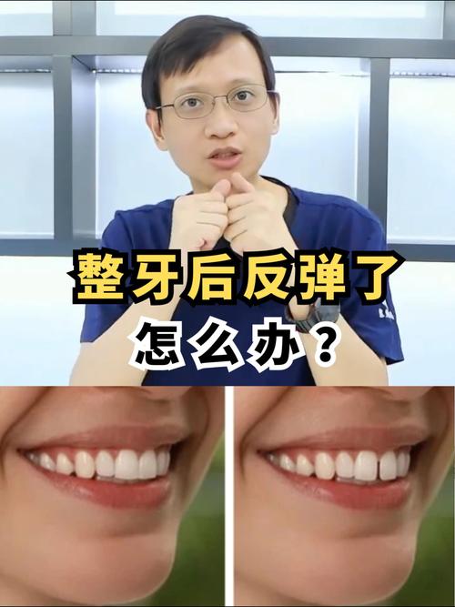 成年后正畸反弹，真的无法避免吗？-图1