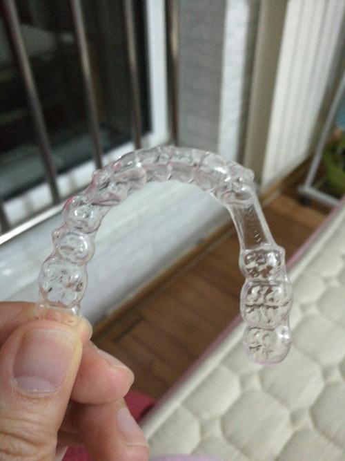 KQ88隐形正畸效果如何?适合哪些人群做呢?-图2 KQ88隐形正畸效果如何?适合哪些人群做呢?-图2