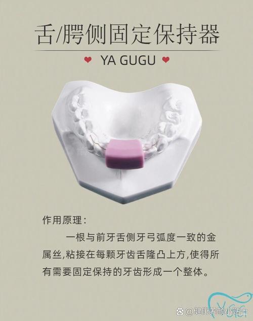 舌侧正畸附件名称-图2