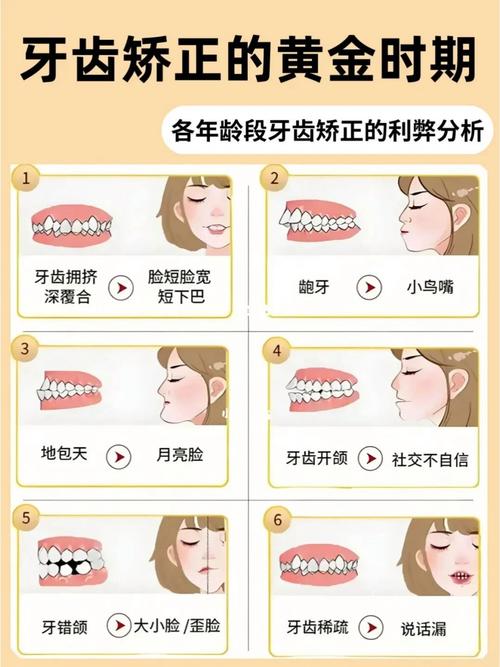 正畸每月历程图片-图3 正畸每月历程图片-图3