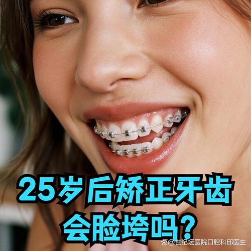 25岁想正畸牙齿，现在开始还来得及吗？-图2