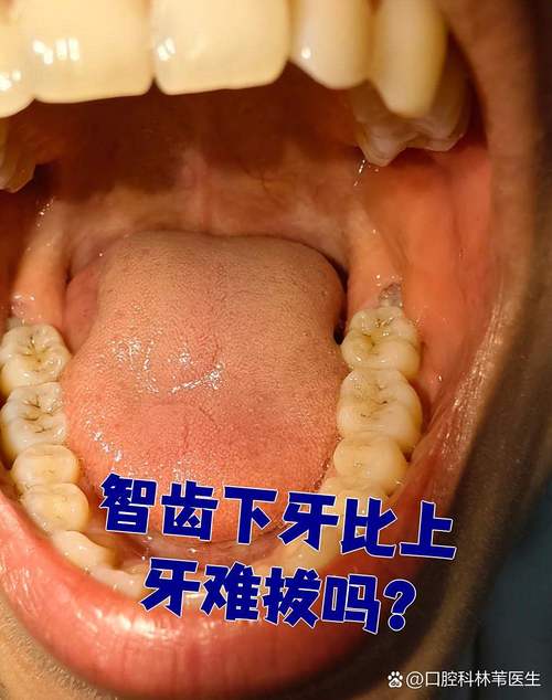 正畸时为啥能发现智齿？检查手段是什么？-图1