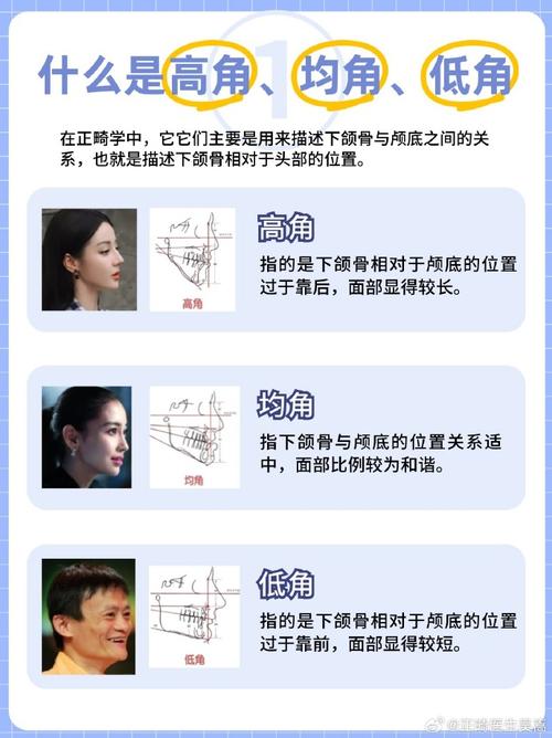正畸高角的测量方法有哪些?步骤、标准及注意事项是什么?-图2 正畸高角的测量方法有哪些?步骤、标准及注意事项是什么?-图2