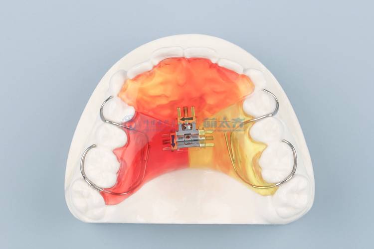 低阻力牙齿正畸器-图1