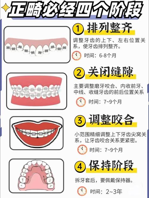 正畸怎么前移磨牙-图1