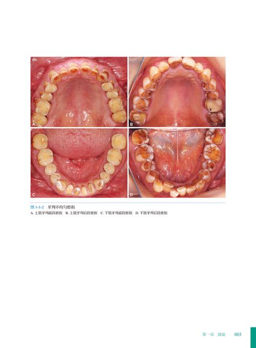 口腔正畸病例有图-图3