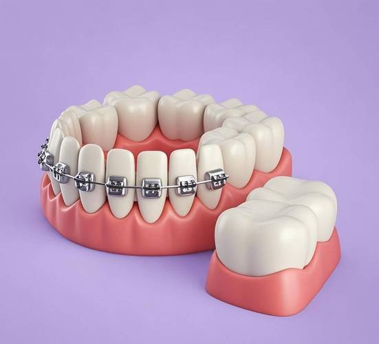 正畸检查通常包含哪些项目？必做检查有哪些？-图1