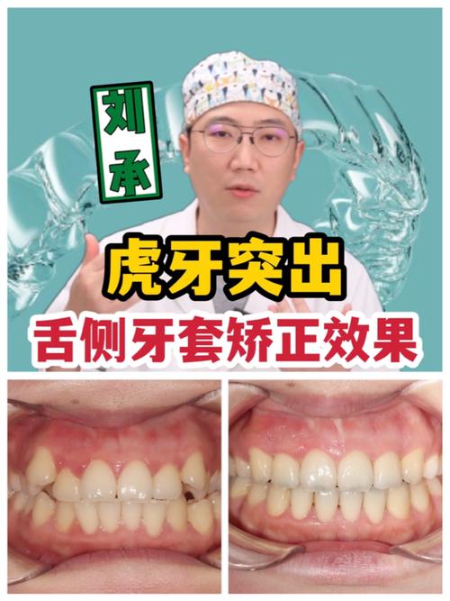 正畸矫正真的能让突出的虎牙变整齐吗？效果怎么样？-图1