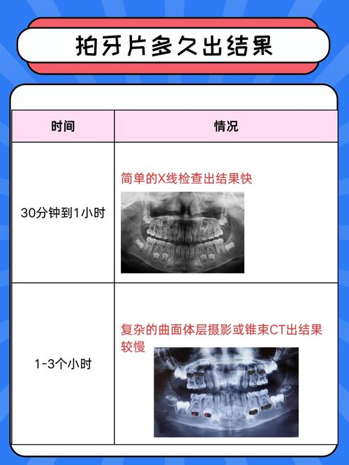 正畸可以拍牙片吗-图3 正畸可以拍牙片吗-图3