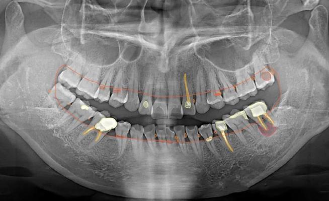 口腔正畸X光检查-图3