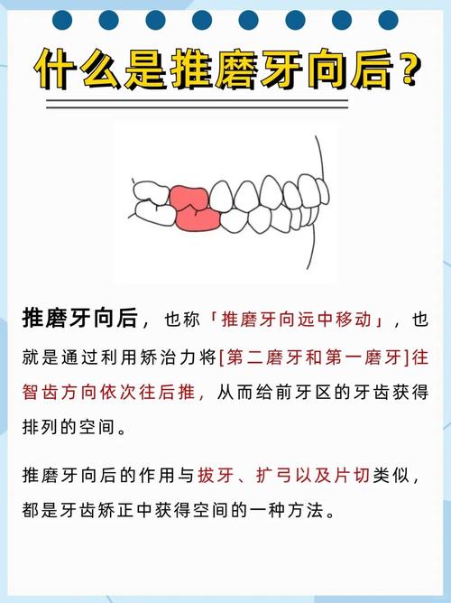 正畸磨牙会移动吗-图2