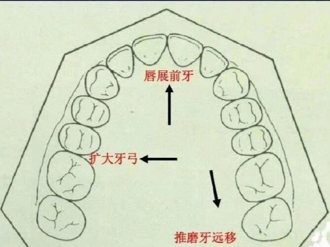 正畸磨牙会移动吗-图3