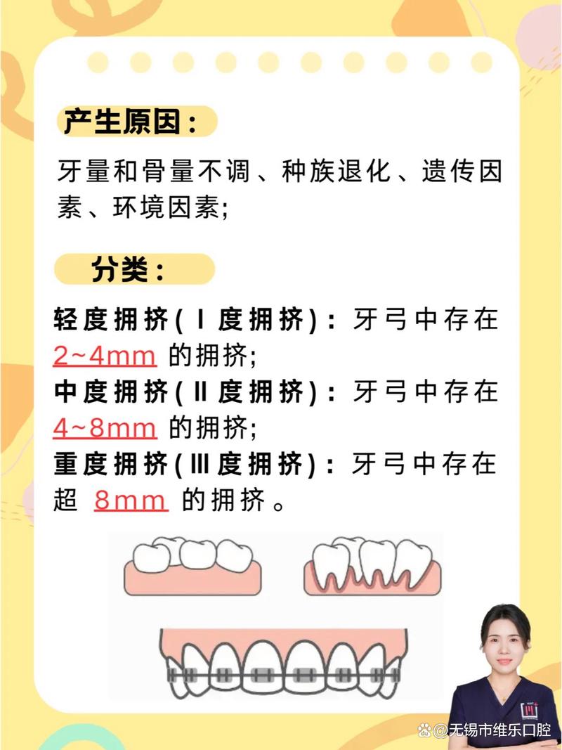 正畸拥挤度如何分类?不同类型对正畸治疗有何影响?-图1 正畸拥挤度如何分类?不同类型对正畸治疗有何影响?-图1
