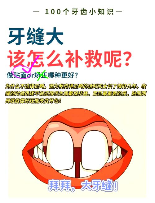 牙缝大正畸的方法-图1 牙缝大正畸的方法-图1