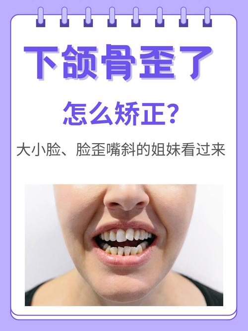 正畸张嘴下巴歪了-图2 正畸张嘴下巴歪了-图2