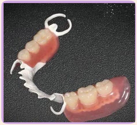 吴江口腔正畸支架矫正效果如何？安全吗？怎么选？-图2