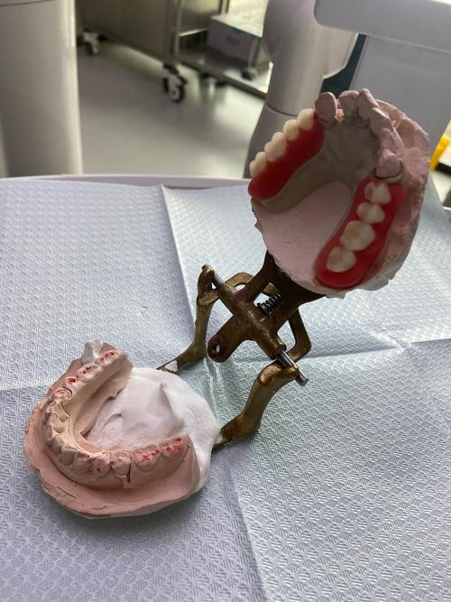 吴江口腔正畸支架矫正效果如何？安全吗？怎么选？-图3