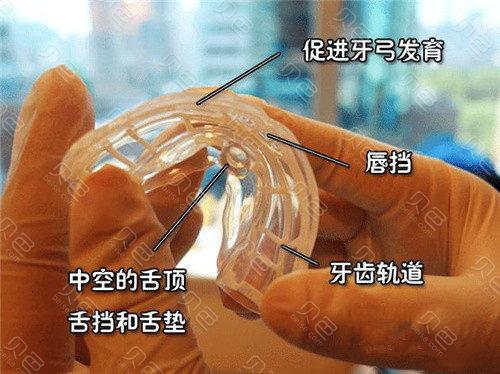 预防性正畸ETA-图3 预防性正畸ETA-图3