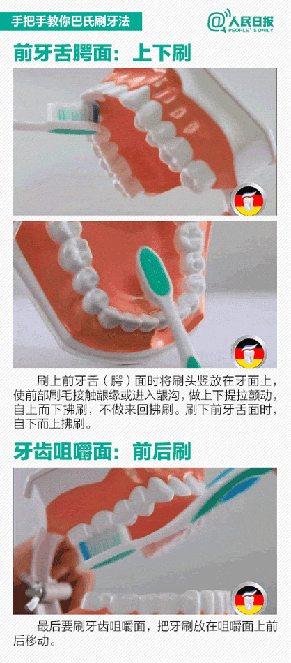 舌侧正畸刷牙方法-图1