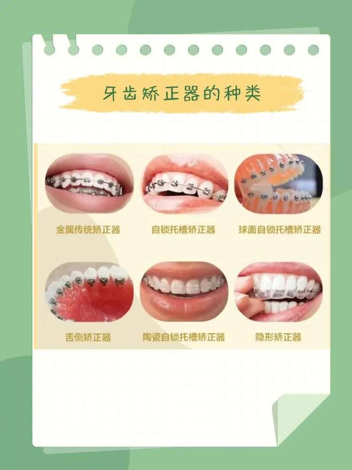 口腔O点表示正畸-图2