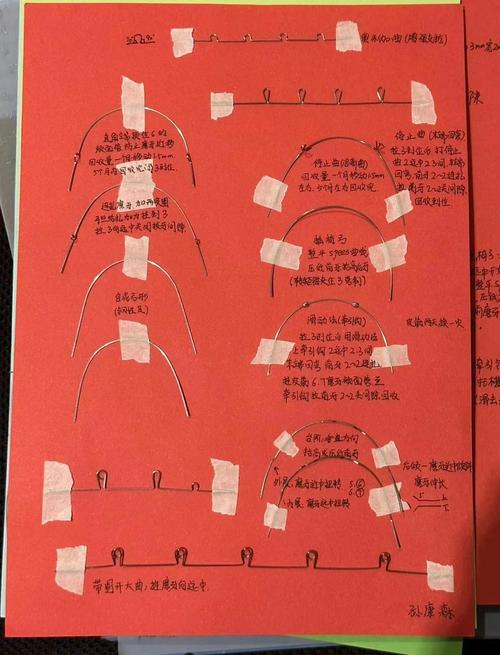 正畸弓丝转矩度数如何精准选择以实现牙齿理想移动？-图2